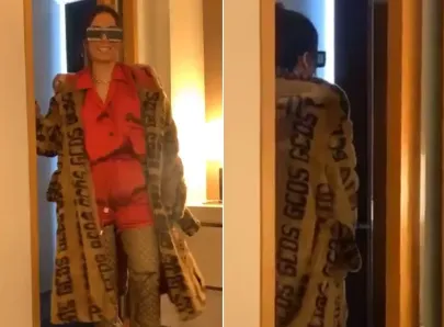 ANITTA USA LOOK DE R$ 13,9 MIL PARA SAIR NA RUA E JUSTIFICA: "SOU ARTISTA"