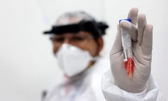 BAHIA TEM 485 NOVOS CASOS DE COVID-19 E MAIS 5 ÓBITOS