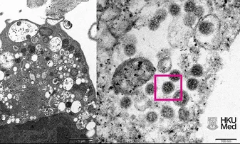 ÔMICRON É VARIANTE QUE SOBREVIVE MAIS TEMPO NA PELE E EM SUPERFÍCIES PLÁSTICAS