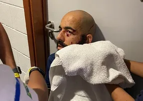 DANILO FERNANDES TRANQUILIZA TORCIDA APÓS SER ATINGIDO EM ATENTADO