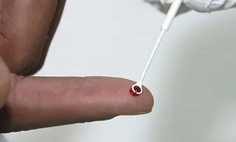 PESQUISADORES ANALISAM COINFECÇÃO POR HIV E HTLV NA BAHIA