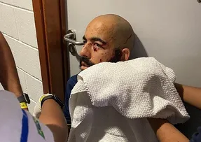 DANILO FERNANDES PASSARÁ POR PROCEDIMENTO NO OLHO