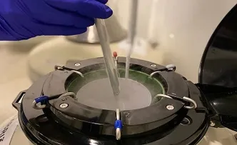 CONGELAMENTO DE ÓVULOS AMPLIA PERSPECTIVAS DA MATERNIDADE