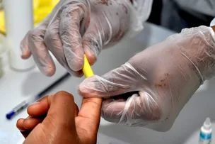 JULHO AMARELO: SECRETARIA PROMOVE AÇÕES DE DIAGNÓSTICO E TRATAMENTO ÁS HEPATITES VIRAIS