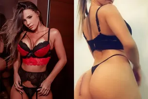 MODELO ACUSA ERRO MÉDICO AO MOSTRAR CICATRIZ NO BUMBUM 