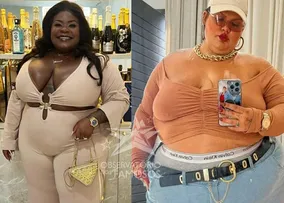 THAIS CARLA SE PRONUNCIA APÓS COMPARAÇÕES SOBRE A CIRURGIA BARIÁTRICA DE JOJO TODYNHO