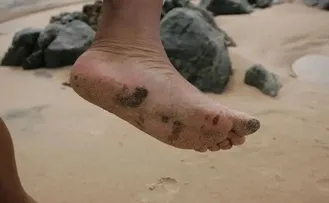 MANCHAS DE ÓLEO VOLTAM A APARECER EM PRAIA DE MUNICÍPIO BAIANO