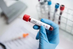 DIA MUNDIAL DE COMBATE À AIDS: MAIS DE 2.304 CASOS DE HIV SÃO REGISTRADOS NA BAHIA