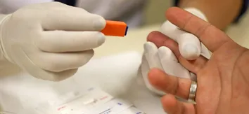 SAÚDE ORIENTA FARMÁCIAS AUTORIZADAS A REALIZAR TESTES RÁPIDOS DE HIV, HEPATITES VIRAIS, SÍFILIS E ISTS