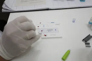 VARIANTE DO HIV GERA ALERTA NA ÁREA MÉDICA