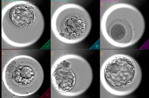 TECNOLOGIA DE ÚLTIMA GERAÇÃO INTEGRADA À INTELIGÊNCIA ARTIFICIAL TRAZ AVANÇOS PARA OS TRATAMENTOS DE FERTILIZAÇÃO IN VITRO (FIV)