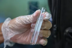 SALVADOR REGISTRA QUEDA DE 26% NO ÍNDICE DE INFESTAÇÃO DO AEDES AEGYPTI