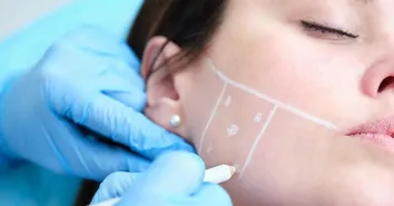 BOTOX VAI ALÉM DA ESTÉTICA E É ALIADO NO ALÍVIO DE DORES OROFACIAIS