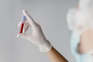 FAKE: DADOS SOBRE HIV NA BAHIA DIVULGADOS EM REDES SOCIAIS SÃO FALSOS E SESAB APRESENTA NÚMEROS REAIS