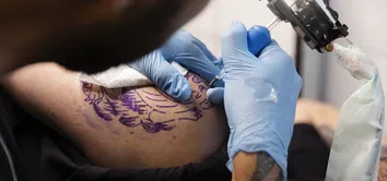 ANESTESIA EM TATUAGENS ESTÉTICAS: O QUE ESTÁ POR TRÁS DA NOVA RESOLUÇÃO DO CFM