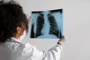 SALVADOR ALERTA PARA TUBERCULOSE E REFORÇA IMPORTÂNCIA DE DIAGNÓSTICO PRECOCE