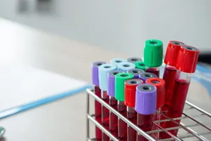 NOVO EXAME DE SANGUE INDICA QUANTO TEMPO DE VIDA VOCÊ AINDA TEM
