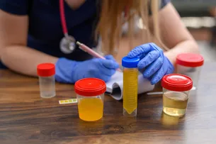 INFECÇÕES URINÁRIAS PODEM INDICAR DESCONTROLE DO DIABETES