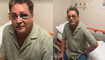 CANTOR LEONARDO SOFRE ACIDENTE APÓS BLEFAROPLASTIA; SAIBA MAIS SOBRE O PROCEDIMENTO